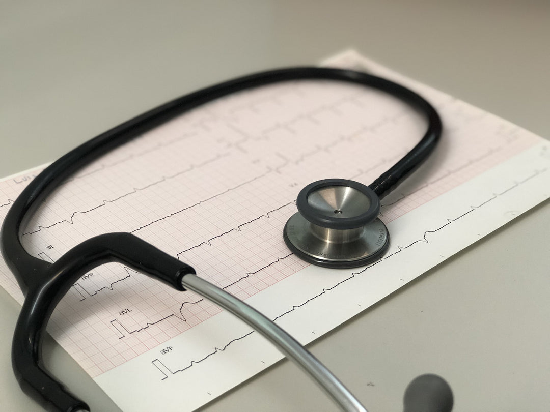 EKG, elektrokardiograma